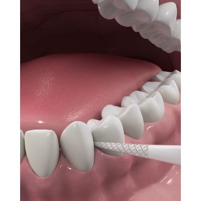 �����-���������� DenTek ������� �������� 75 ��. (047701002704) - �������� 6