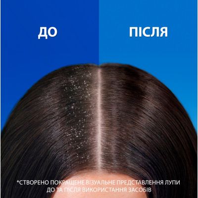 ������� Head & Shoulders Pro-Expert 7 ����������� �������� 250 �� (8700216156844) - �������� 3