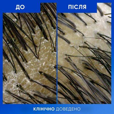 ������� Head & Shoulders Clarify & Shine ����� ���� �������� �� ����� 400 �� (8700216658461) - �������� 7