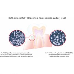 Зубная паста Dr. Wild Emofluor Daily Care со стабилизированным фторидом олова 75мл (7611841701686) - Картинка 4