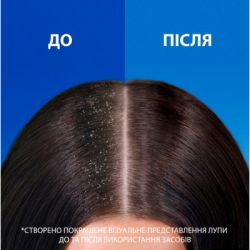 Шампунь Head & Shoulders Pro-Expert 7 Интенсивное спасение 250 мл (8700216156844) - Картинка 3