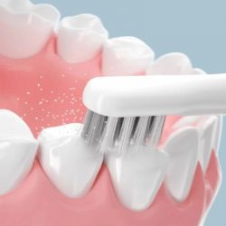 Электрическая зубная щетка Xiaomi T501 - blue - Картинка 8