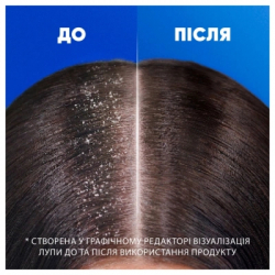 Шампунь Head & Shoulders 2 в 1 Против перхоти Основной уход 250 мл (8700216157872) - Картинка 6